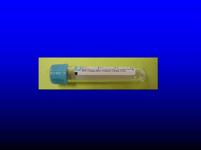 Coagulation test blood lab