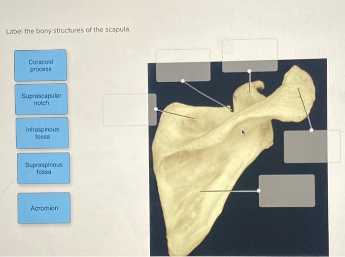 Label the bony structures of the scapula.