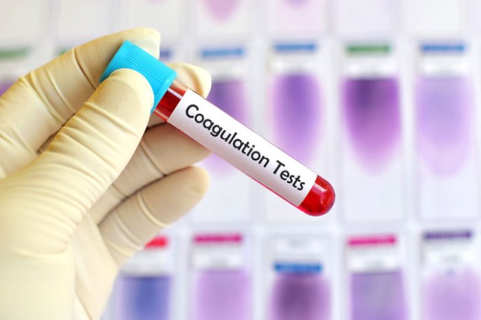 A coagulation test requiring 3ml