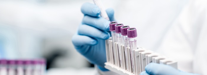 Coagulation tests diagnosis