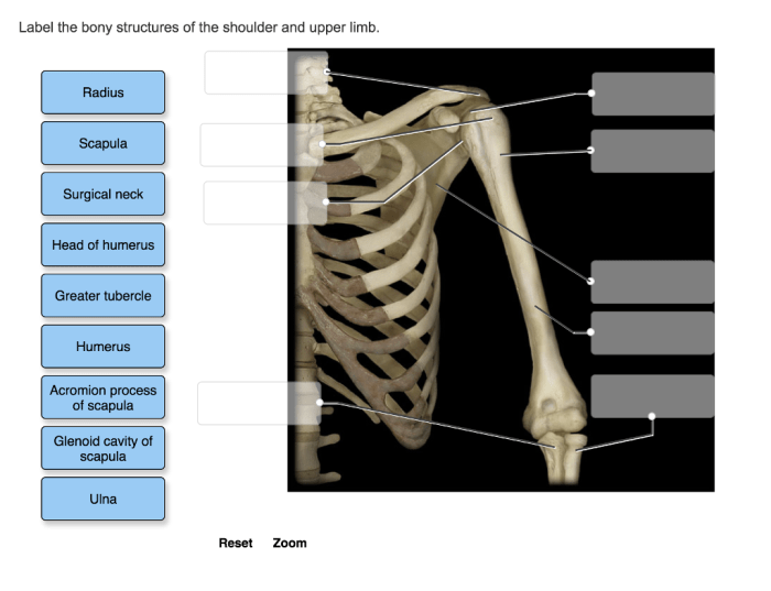 Label the bony structures of the scapula.